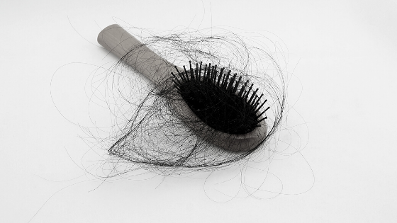 Can I stop my hair loss